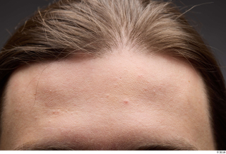 HD Face Skin Kenan face forehead hair skin pores skin…